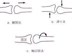 関節療法①　AKA治療法